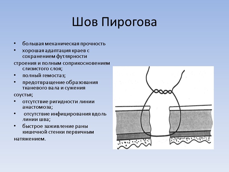 Шов Пирогова большая механическая прочность хорошая адаптация краев с сохранением футлярности строения и полным